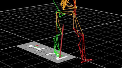 Analyse de la marche lors de la rééducation pour l’amélioration de la mobilité des personnes amputées