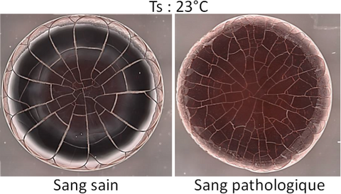 Plateforme Microfluidique