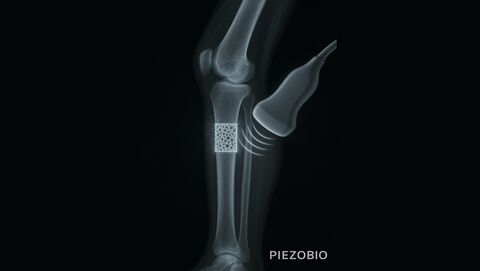 PIEZOBIO - matériaux piézoélectriques imprimables en 3D/4D pour le secteur biomédical