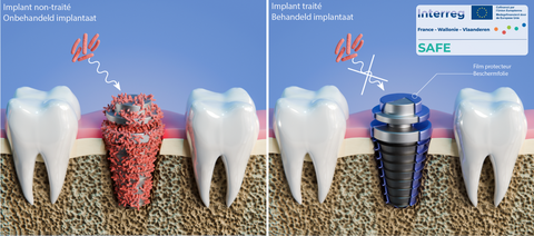Implant non-traité et implant traité - Onbehandeld implantaat en behandeld implantaat